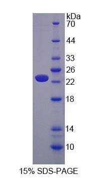 Recombinant Calcium Channel, Voltage Dependent, L-Type, Alpha 1S Subunit (CACNa1S)