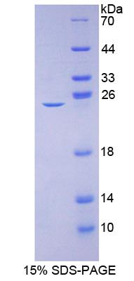 Recombinant Calcium Channel, Voltage Dependent, L-Type, Alpha 1C Subunit (CACNa1C)