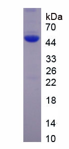 Recombinant Calcium Channel, Voltage Dependent, L-Type, Alpha 1D Subunit (CACNa1D)