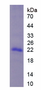 Recombinant Centrin 1 (CETN1)