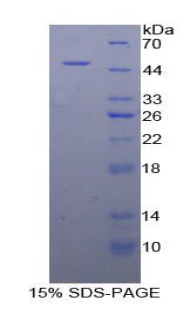 Recombinant Carboxypeptidase E (CPE)