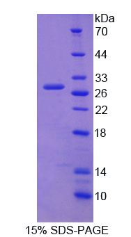 Recombinant Carboxypeptidase Z (CPZ)