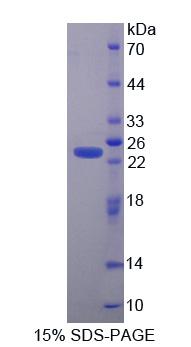 Recombinant Cysteine And Glycine Rich Protein 1 (CSRP1)