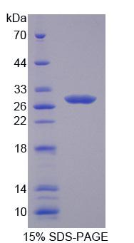 Recombinant Cysteine Rich Secretory Protein 2 (CRISP2)