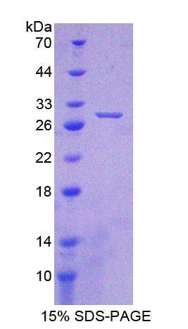 Recombinant Crystallin Beta A1 (CRYbA1)