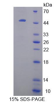 Recombinant Crystallin Beta B1 (CRYbB1)