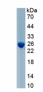 Recombinant Crystallin Beta B2 (CRYbB2)