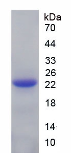 Recombinant Crystallin Beta B2 (CRYbB2)