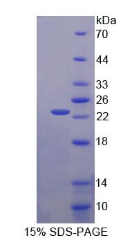 Recombinant Crystallin Beta B2 (CRYbB2)