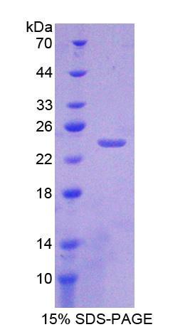 Recombinant Crystallin Gamma S (CRYgS)