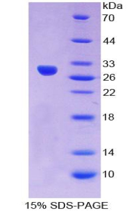 Recombinant Crystallin Lambda 1 (CRYl1)