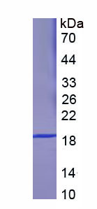 Recombinant Heat Shock Protein Beta 6 (HSPb6)