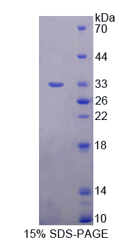 Recombinant Docking Protein 3 (DOK3)