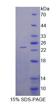 Recombinant Dipeptidase 2 (DPEP2)