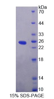 Recombinant Exocyst Complex Component 3 (EXOC3)