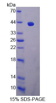 Recombinant Exocyst Complex Component 3 (EXOC3)