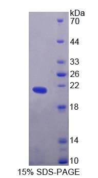 Recombinant Endothelin 2 (EDN2)