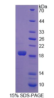Recombinant Fatty Acid Desaturase 2 (FADS2)