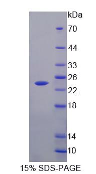 Recombinant Fibronectin Leucine Rich Transmembrane Protein 1 (FLRT1)