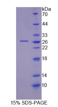 Recombinant G-Elongation Factor, Mitochondrial 2 (GFM2)