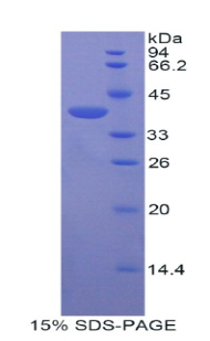 Recombinant Centaurin Alpha 2 (CENTa2)