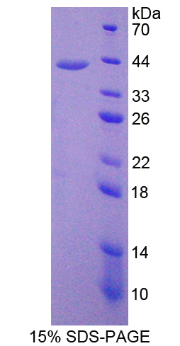 Recombinant Centaurin Alpha 2 (CENTa2)