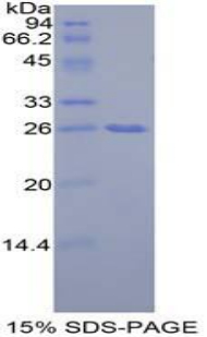 Recombinant Growth Factor Receptor Bound Protein 7 (Grb7)