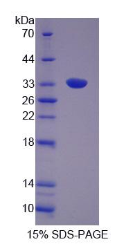Recombinant Huntingtin Interacting Protein 1 (HIP1)