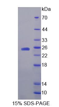 Recombinant Hippocalcin (HPCA)