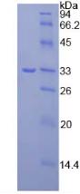 Recombinant Janus Kinase 3 (JAK3)