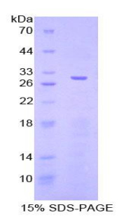 Recombinant Janus Kinase 3 (JAK3)