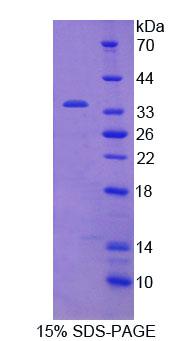 Recombinant Janus Kinase 2 (JAK2)