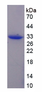 Recombinant Kinesin Family, Member 1A (KIF1A)