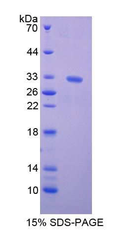 Recombinant Kinesin Family, Member 5B (KIF5B)