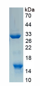 Recombinant Kinesin Family, Member 14 (KIF14)