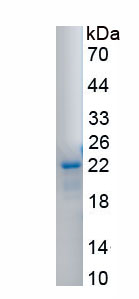 Recombinant Kinesin Family, Member 23 (KIF23)