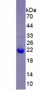 Recombinant Leukocyte Cell Derived Chemotaxin 2 (LECT2)