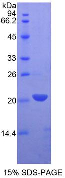 Recombinant Leukocyte Cell Derived Chemotaxin 2 (LECT2)