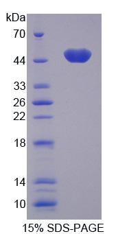 Recombinant Lamin A/C (LMNA)