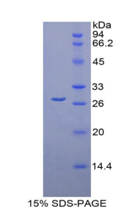 Recombinant Lysyl Oxidase Like Protein 1 (LOXL1)