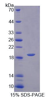 Recombinant Vesicle Associated Membrane Protein Associated Protein B (VAPB)