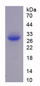 Recombinant Multimerin 2 (MMRN2)