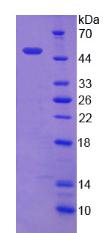 Recombinant Metastasis Associated Protein 2 (MTA2)