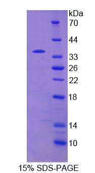 Recombinant Phosphodiesterase 4B, cAMP Specific (PDE4B)