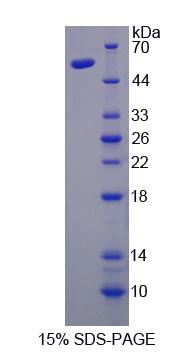Recombinant Nuclear Transcription Factor Y Gamma (NFYC)