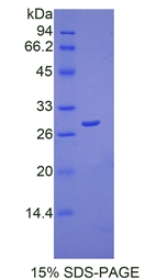 Recombinant Peroxiredoxin 3 (PRDX3)