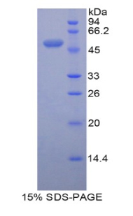 Recombinant Peroxiredoxin 3 (PRDX3)