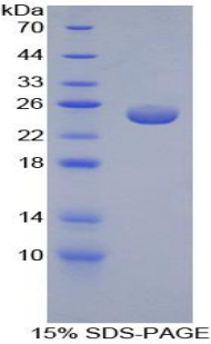 Recombinant Peroxiredoxin 5 (PRDX5)