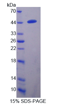 Recombinant Transmembrane Protease, Serine 4 (TMPRSS4)