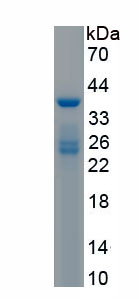 Recombinant Transient Receptor Potential Cation Channel Subfamily A, Member 1 (TRPA1)